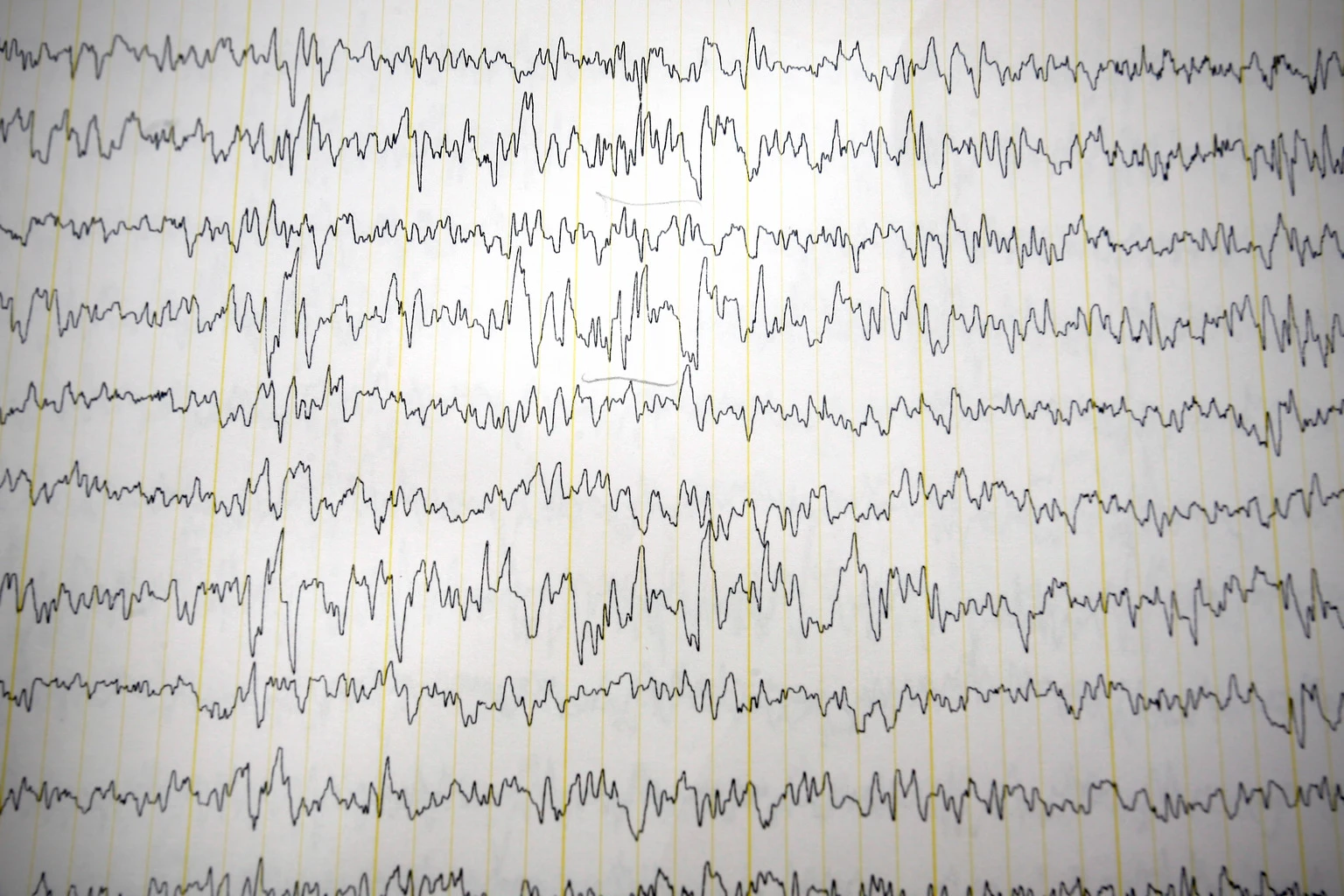 Ovid Therapeutics: Risk-Adjusted Valuation Shows Deep Discount Despite 700% Rally